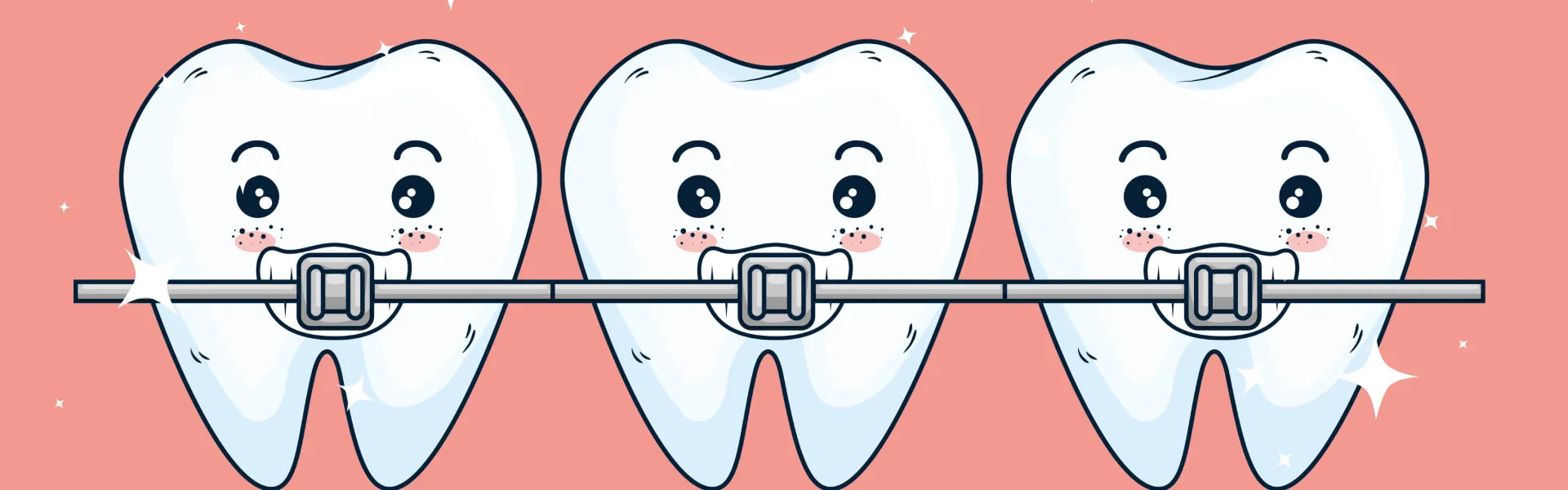 Teeth Alignment Options: A Guide to Braces (2025)